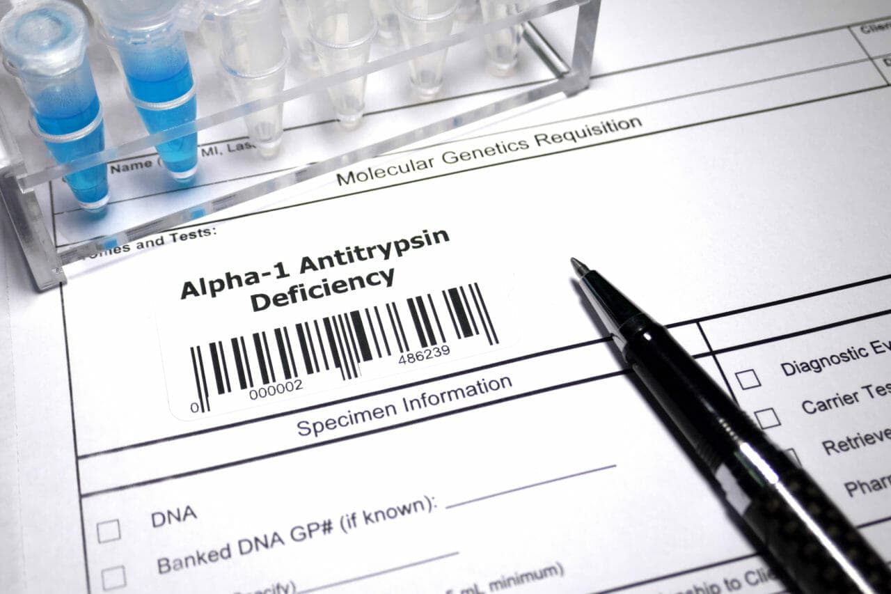 Дефицит альфа-1-антитрипсина