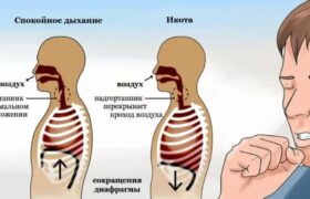 Как быстро избавиться от икоты