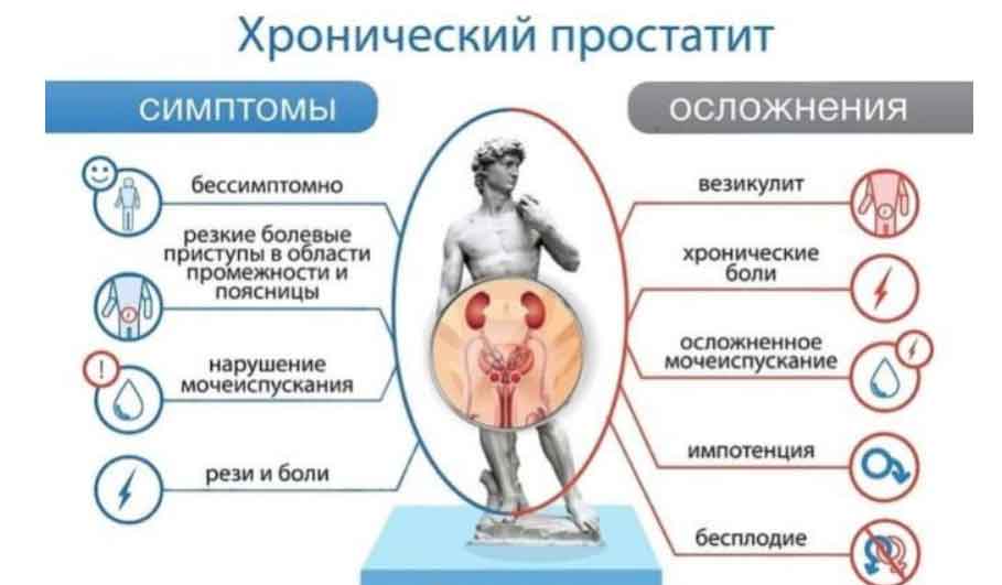 Как лечить хронический простатит? Комплексный лечебный подход