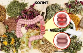 Лечение язвенного колита народными средствами