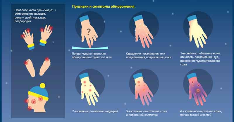 Что надо делать при обморожении рук