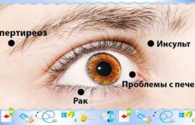 Какие можно болезни определить по глазам