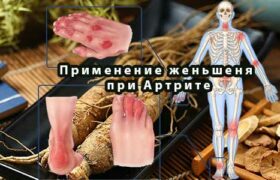 Применение женьшеня при Артрите
