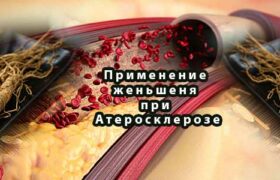 Применение женьшеня при Атеросклерозе