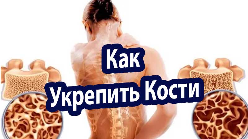 ак Укрепить Кости: Простые Советы. Об Остеопорозе и Как Их Избежать