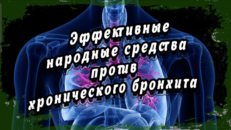 Эффективные народные средства против хронического бронхита. Домашние методы лечения